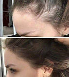 Сироватка-спрей проти випадіння волосся. Крок 5, фото 4