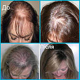 Сироватка-спрей проти випадіння волосся. Крок 5, фото 5