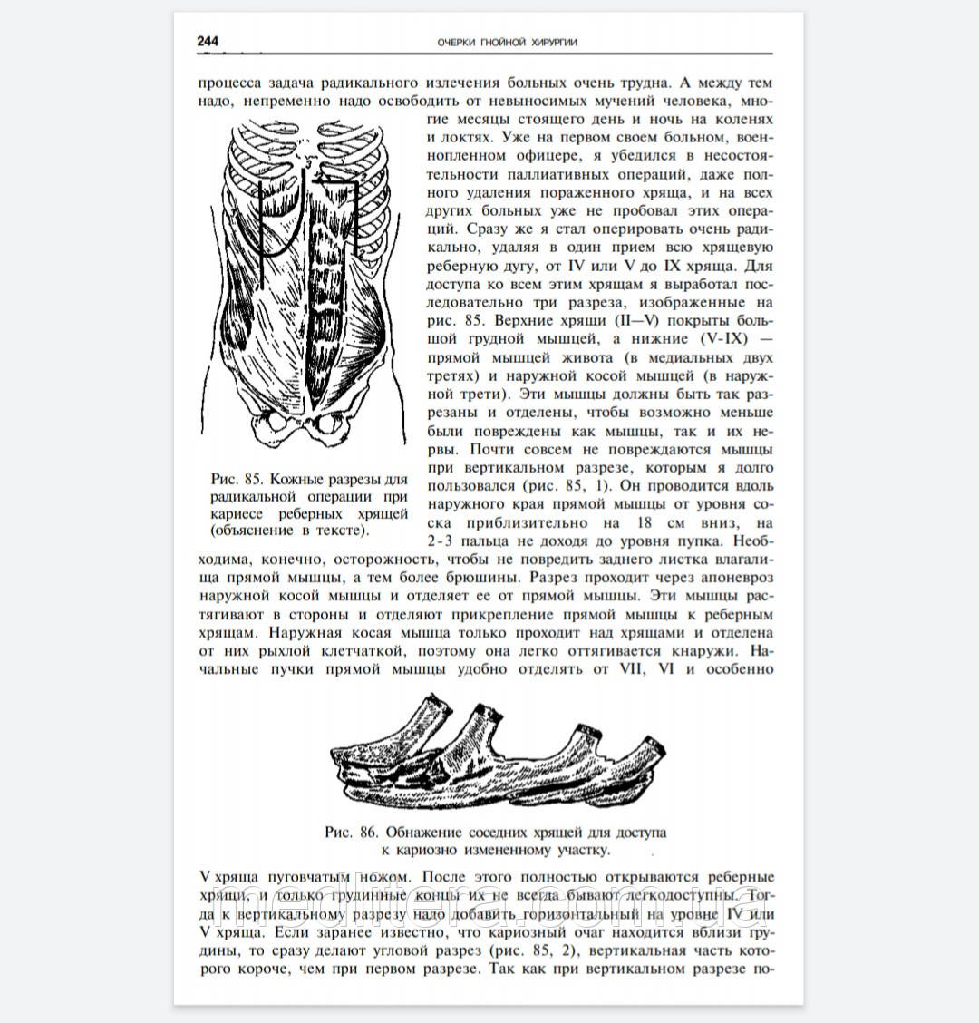 Войно-Ясенецкий В.Ф. Очерки гнойной хирургии 2020 год - фото 7 - id-p40769755