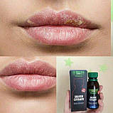 Біокомплекс "Цитрат срібла", фото 4