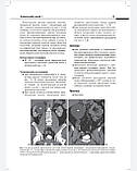 Олдер А. Р., Бассиньяни М. Дж. Атлас візуалізації в урології, фото 4