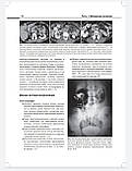 Олдер А. Р., Бассиньяни М. Дж. Атлас візуалізації в урології, фото 3