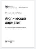 Альбанова В. І., Пампура А. Н. Атопічний дерматит. Бібліотека лікаря-спеціаліста 2020 рік, фото 3