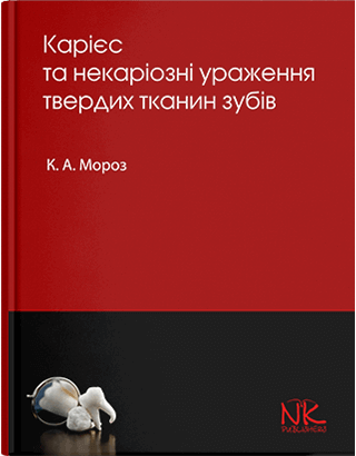 Книга "Карієс та некаріозні ураження твердих тканин зубів" Мороз К. А.