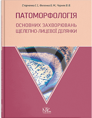 Книга "Патоморфологія основних захворювань щелепно-лицьової ділянки" Старченко І.І., Філенко Б.М. та ін.