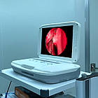 Портативна ендоскопічна камера медична LAPOMED™ PFHD-II, фото 2