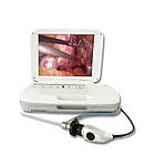 Портативна ендоскопічна камера медична LAPOMED™ PFHD-II, фото 3