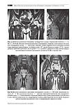 Труфанов МРТ. Суглоби нижньої кінцівки + МРТ Суглоби верхньої кінцівки Посібники по МРТ  комплект, фото 3