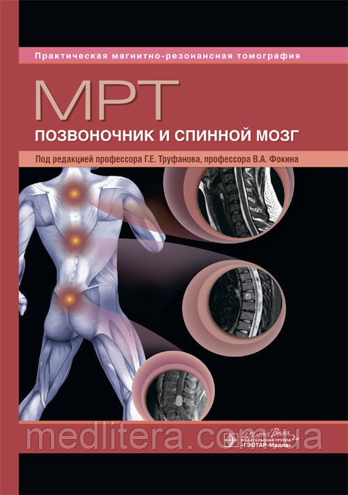 Труфанов Г.Е. МРТ. Позвоночник и спинной мозг. Практическая магнитно-резонансная томография 2020 год