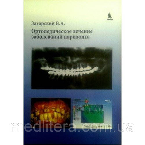 Загорський Ст. А. Ортопедичне лікування захворювань пародонта