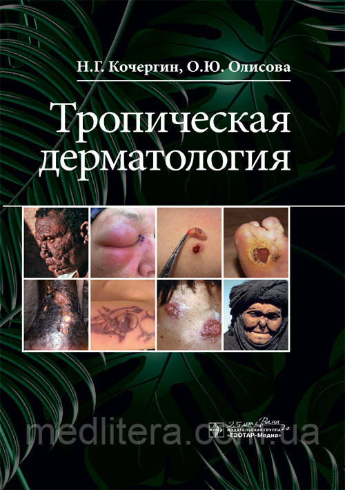 Тропічна дерматологія / Н. Р. Кочергін, О. Ю. Олисова. 2020 рік
