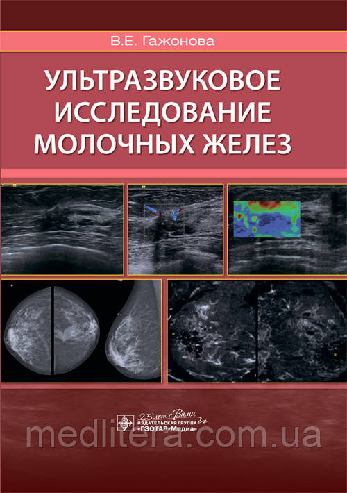 Ультразвукове дослідження молочних залоз / В. Е. Гажонова. 2020 рік