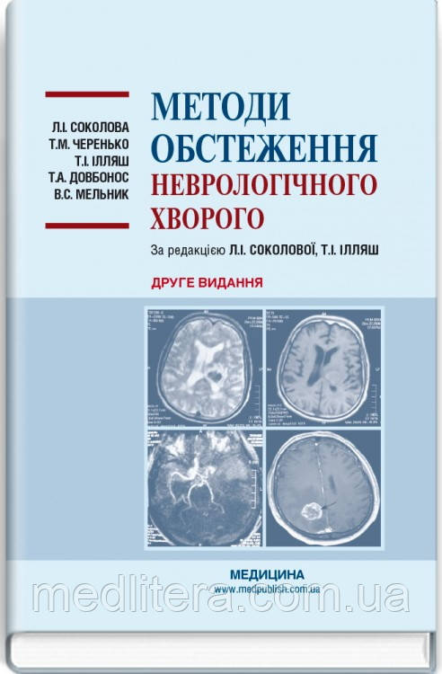 Соколова Л. І. Черенько Т. М. Методи обстеження неврологічного хворого.