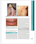 Клаус Вольф Дерматологія Фіцпатріка в клінічній практиці. ТОМ 2, фото 9