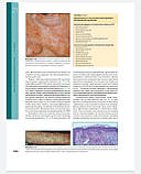 Клаус Вольф Дерматологія Фіцпатріка в клінічній практиці. ТОМ 2, фото 8