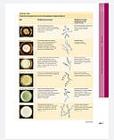 Клаус Вольф, Лоуелл А. Голдсміт Дерматологія Фіцпатріка в клінічній практиці ТОМ 3, фото 7