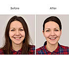 Набір багаторазових патчів для особи (16 шт), фото 6