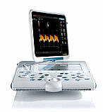 Ультразвуковий апарат MyLab Alpha, фото 2