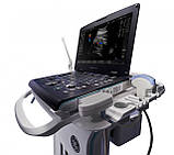 Портативна ультразвукова система Active Versana, фото 2