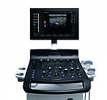 Універсальна ультразвукова система Versana Essential, фото 6