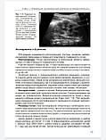 Пыков М.И. Детская ультразвуковая диагностика. Учебник. т.2. Уронефрология., фото 9