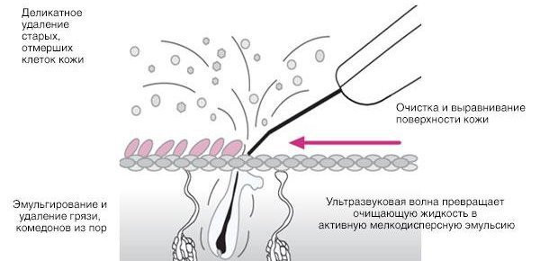 Пилинг- деликаное удаление старых, отмерших клеток