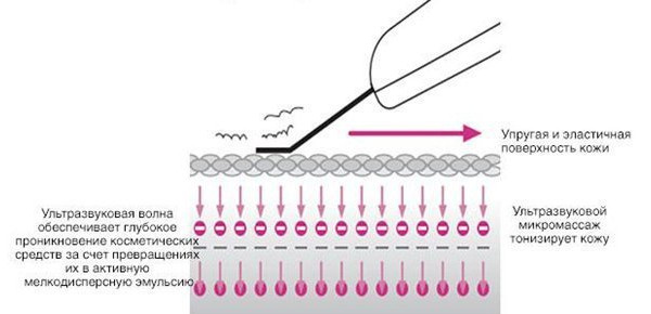 Ультразвуковой массаж тонизирует кожу