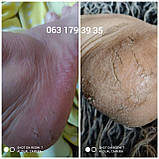 ОРИГІНАЛ 120 мл. Фруктова кислота з алое вера Dermapharms UK, фото 8
