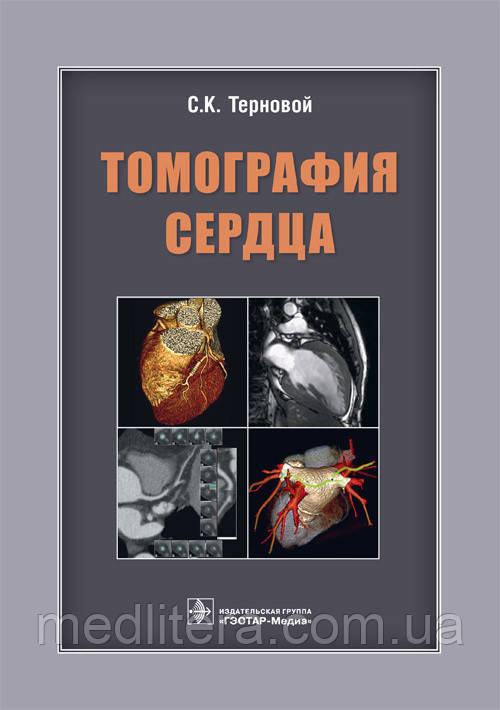 Терновий С. К. Томографія серця 2018 рік