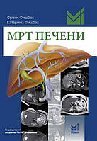 Фишбах Ф. МРТ ПЕЧЕНИ ДИАГНОСТИКА, ДИФФЕРЕНЦИАЛЬНАЯ ДИАГНОСТИКА, ПРИНЦИПЫ ЛЕЧЕНИЯ Перевод с нем 2018 г.