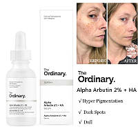 The Ordinary Alpha Arbutin 2% + HA сыворотка для осветления пигментных пятен