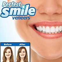 Знімні вініри елайнери Veneers Snap-on smile, фото 4