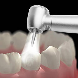 Використання турбінних наконечників в стоматології