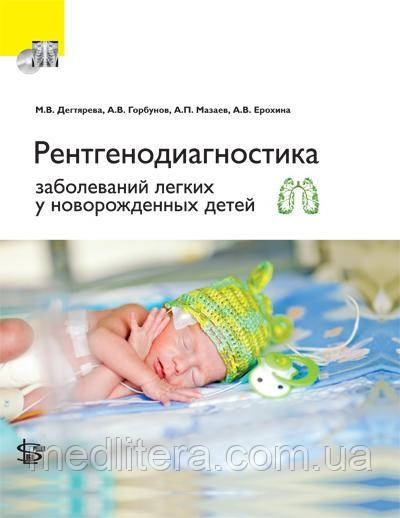 Дегтярьова М. В. Єрохіна А. В., Рентгенодіагностика захворювань легень у новонароджених дітей
