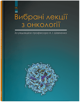 Книга "Вибрані лекції з онкології" Шевченко А. І. та ін.