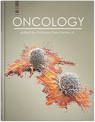 Книга "Oncology=Онкологія" Шевченко А. І., Колесник О. П., Шевченко Н. Ф. та ін.