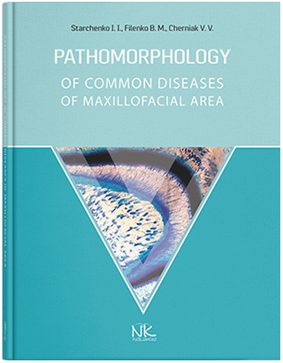 Книга "Pathomorphology of Common Diseases of Maxillofacial Area= Патоморфологія захворювань