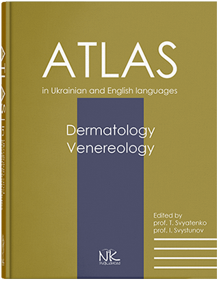 Книга "Дерматологія. Венерологія = Dermatology. Venereology : атлас укр. та англ. мовами Святенко Т. В., Сві
