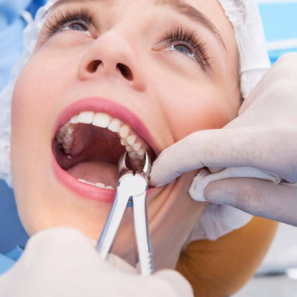 Щипці для видалення зубів. Статті компанії «Dental Group»