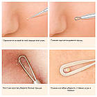 Інструменти для видалення вугрів, прищів Beauty Care в металевому футлярі, фото 4