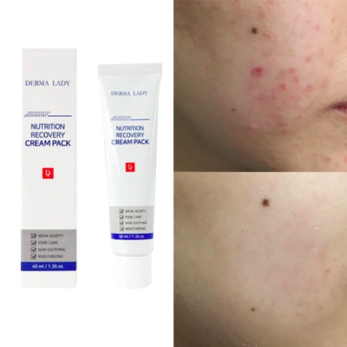 Derma Lady Nutrition Recovery Cream Pack Відновлювальний крем-маска 40ml