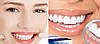 Відбілюючі смужки для зубів Ultra Whitening Gel Strips | Відбілювач для зубів, фото 3