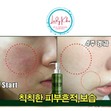 Гель для глибокого очищення шкіри з детокс-ефектом MEDI-PEEL ALGO-TOX Deep Clear, 150ml, фото 5