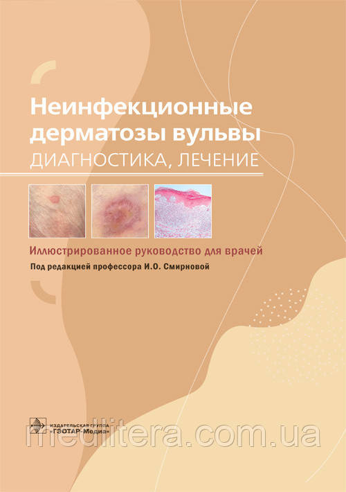 В. О. Смирнової Неінфекційні дерматози вульви. Діагностика, лікування. Ілюстроване керівництво 2021 рік
