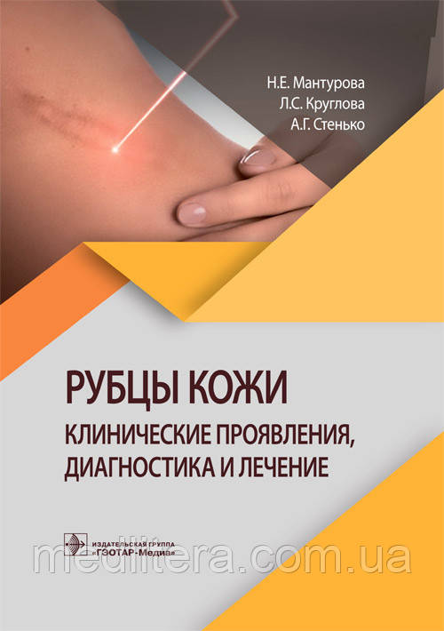 Мантурова Н.Е., Круглова Л. С., Рубці шкіри. Клінічні прояви, діагностика і лікування 2021 рік