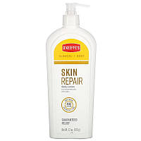 O Keeffe's Відновлення шкіри, лосьйон для тіла для дуже сухої шкіри, що свербить, 340 г
