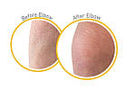 O'Keeffe's Skin Repair Body Lotion Відновлення шкіри, лосьйон для тіла для дуже сухої шкіри, що свербить, 340 г, фото 3
