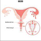 Набір менструальних чаш Pretty Woman L і S з мішечком для зберігання, фото 5