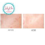 Пілінг-маска з детокс- ефектом MEDI-PEEL Herbal Peel Tox Wash Off Type Cream Mask, 120ml, фото 7