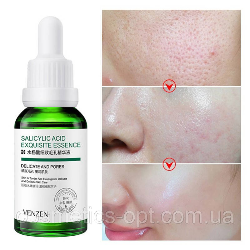 Сироватка для проблемної шкіри «Контроль Жирності та висипок» Veze Salicylic Acid, 30 ml